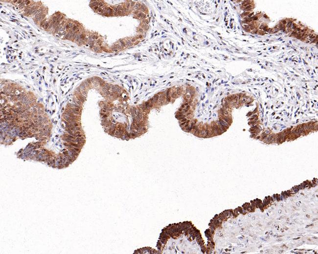 WDR77 Antibody in Immunohistochemistry (Paraffin) (IHC (P))