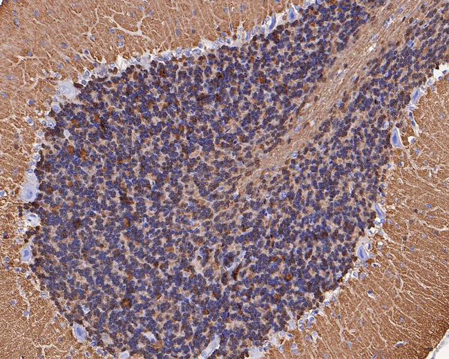 VSNL1 Antibody in Immunohistochemistry (Paraffin) (IHC (P))