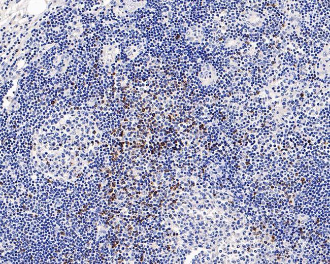 CTLA-4 Antibody in Immunohistochemistry (Paraffin) (IHC (P))