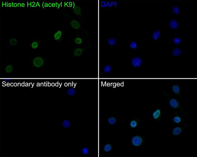 H2AK9ac Antibody in Immunocytochemistry (ICC/IF)