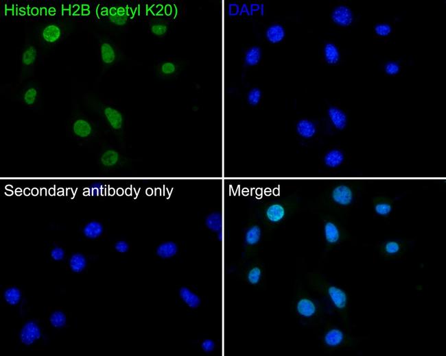 H2BK20ac Antibody in Immunocytochemistry (ICC/IF)