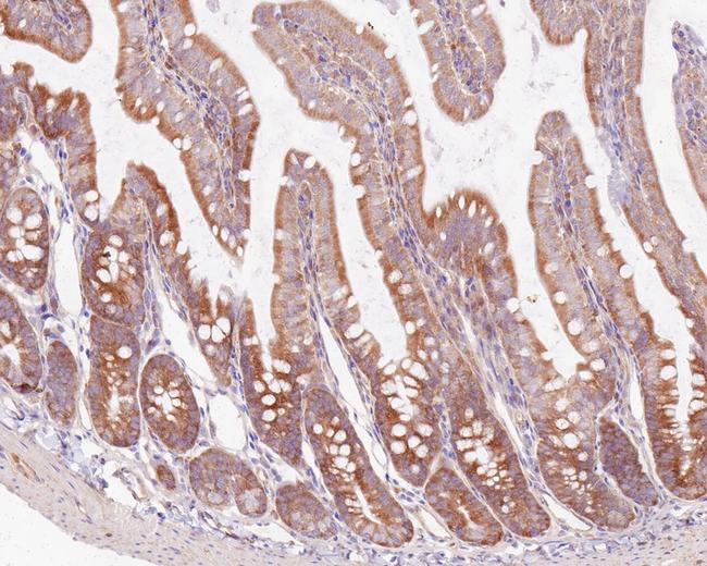 ASC1 Antibody in Immunohistochemistry (Paraffin) (IHC (P))