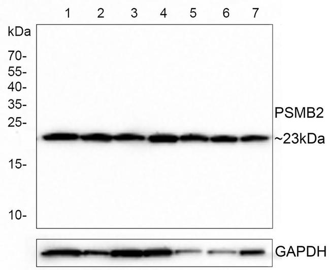 PSMB2 Antibody in Western Blot (WB)