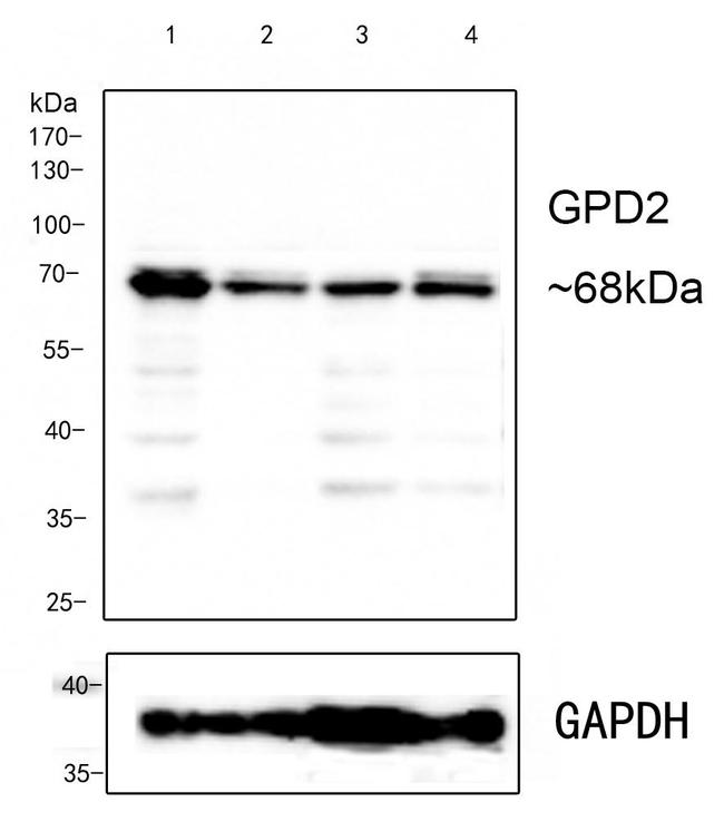 GPD2 Antibody in Western Blot (WB)