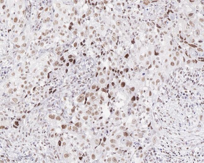 Menin Antibody in Immunohistochemistry (Paraffin) (IHC (P))