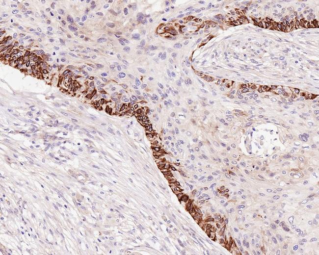 BAX Antibody in Immunohistochemistry (Paraffin) (IHC (P))