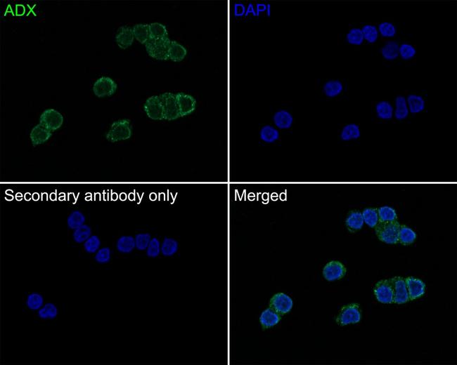 FDX1 Antibody in Immunocytochemistry (ICC/IF)