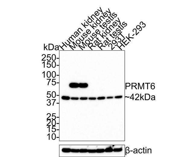 PRMT6 Antibody in Western Blot (WB)