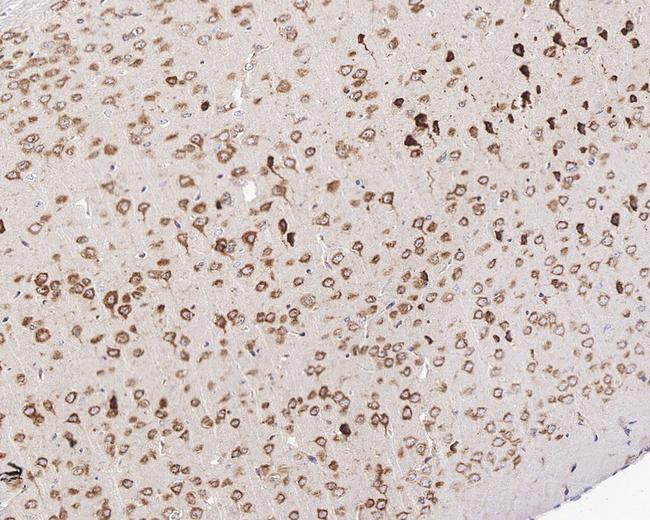 GABBR1 Antibody in Immunohistochemistry (Paraffin) (IHC (P))