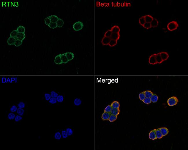 RTN3 Antibody in Immunocytochemistry (ICC/IF)