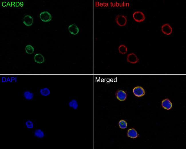 CARD9 Antibody in Immunocytochemistry (ICC/IF)