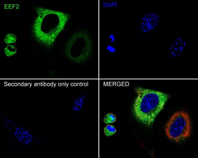 EEF2 Antibody in Immunocytochemistry (ICC/IF)