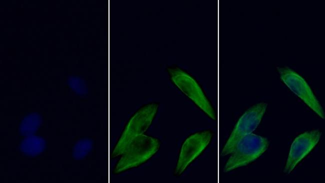 beta Tubulin Antibody in Immunocytochemistry (ICC/IF)