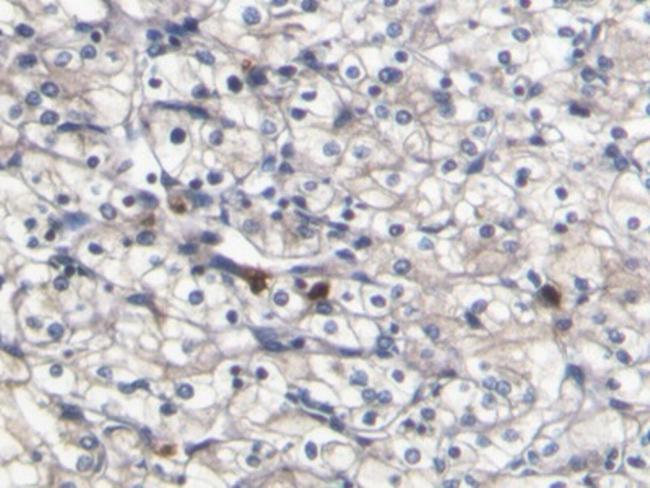 S100A8 Antibody in Immunohistochemistry (Paraffin) (IHC (P))