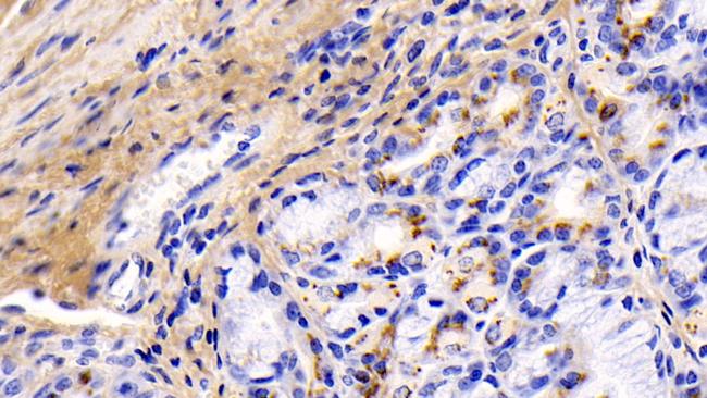 COL1A1 Antibody in Immunohistochemistry (Paraffin) (IHC (P))