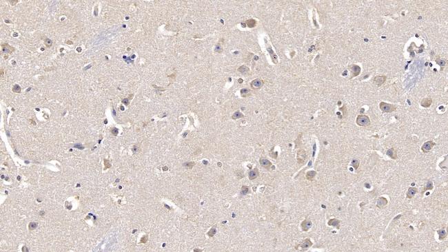 FGF13 Antibody in Immunohistochemistry (Paraffin) (IHC (P))