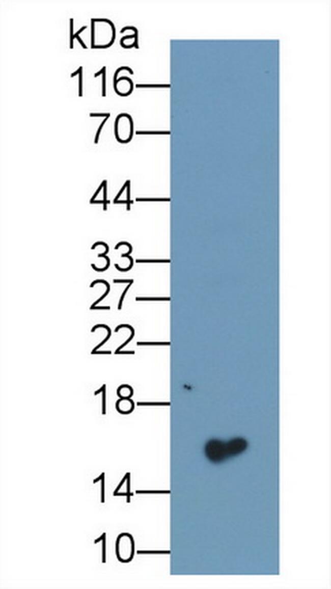 CST1 Antibody in Western Blot (WB)