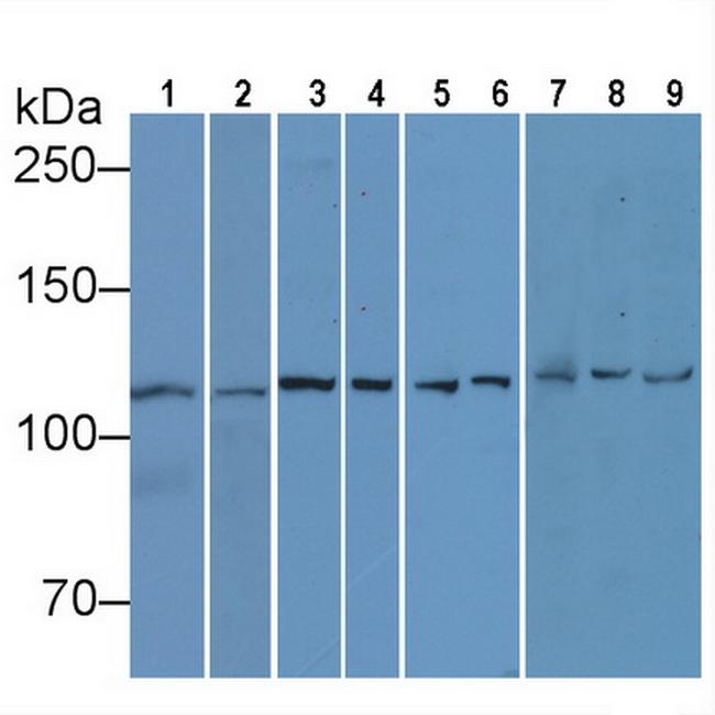 Vinculin Antibody in Western Blot (WB)