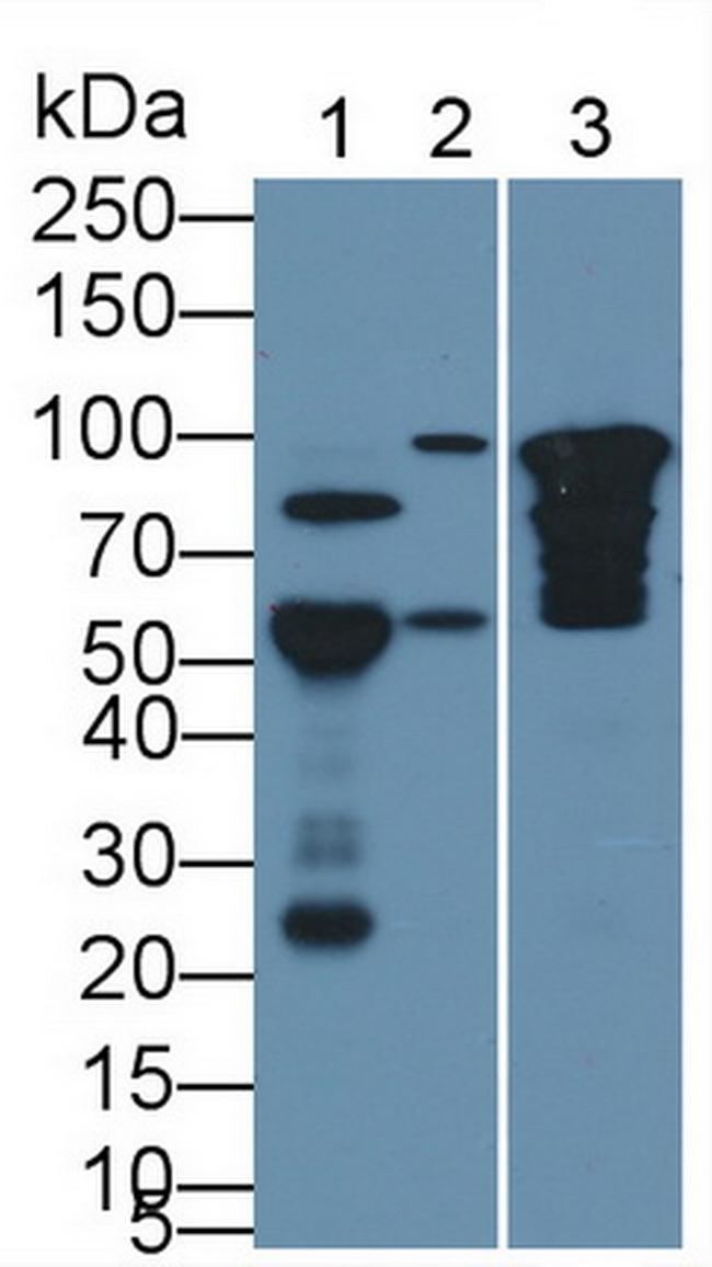 COMP Antibody in Western Blot (WB)