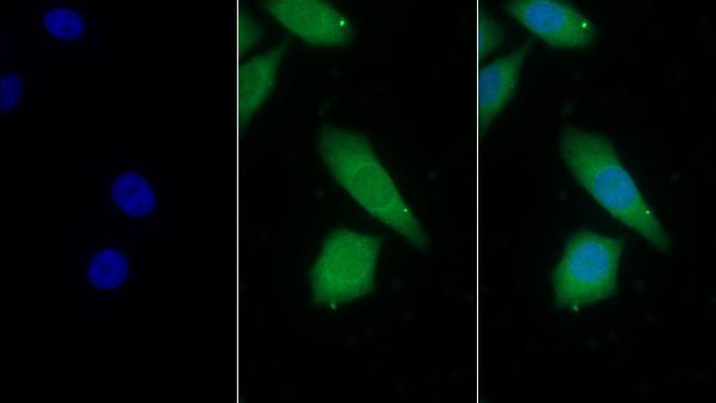 Prothrombin Fragment 1/2 Antibody in Immunocytochemistry (ICC/IF)