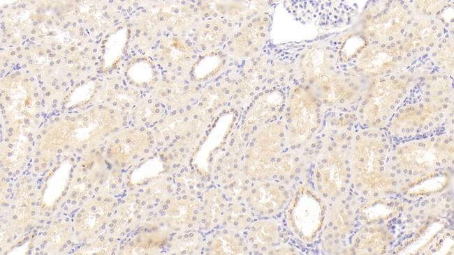 CTRP1 Antibody in Immunohistochemistry (Paraffin) (IHC (P))