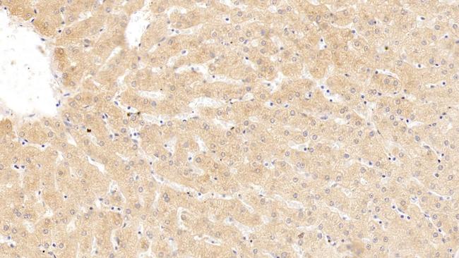 SERPINA10 Antibody in Immunohistochemistry (Paraffin) (IHC (P))