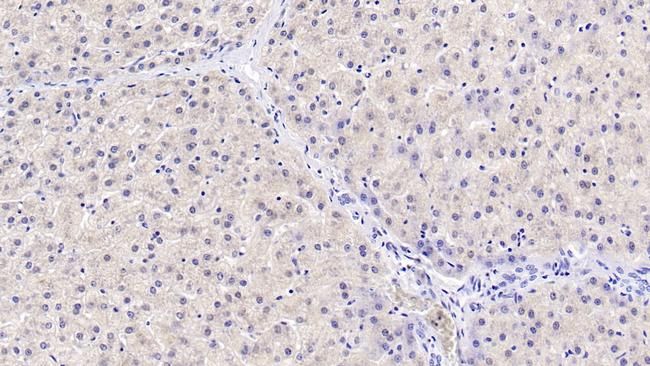 HPD Antibody in Immunohistochemistry (Paraffin) (IHC (P))