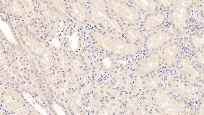 MSRA Antibody in Immunohistochemistry (Paraffin) (IHC (P))