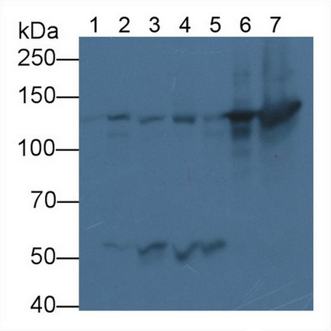 Nephrin Antibody in Western Blot (WB)