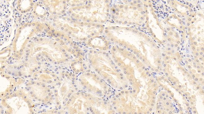 SERPINF2 Antibody in Immunohistochemistry (Paraffin) (IHC (P))