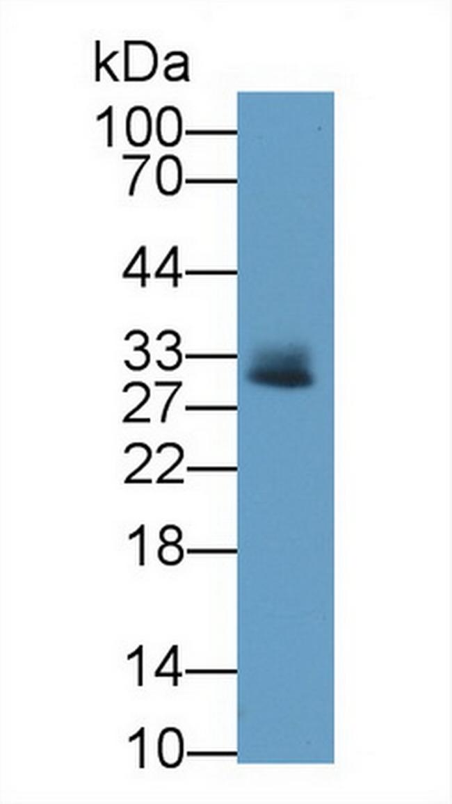 Tryptase Antibody in Western Blot (WB)