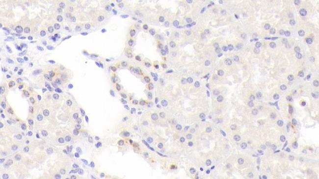 BMP6 Antibody in Immunohistochemistry (Paraffin) (IHC (P))