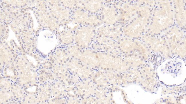 PAI1 Antibody in Immunohistochemistry (Paraffin) (IHC (P))