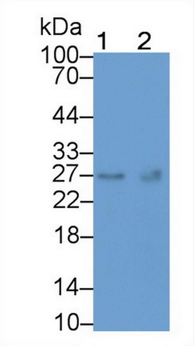 TK1 Antibody in Western Blot (WB)