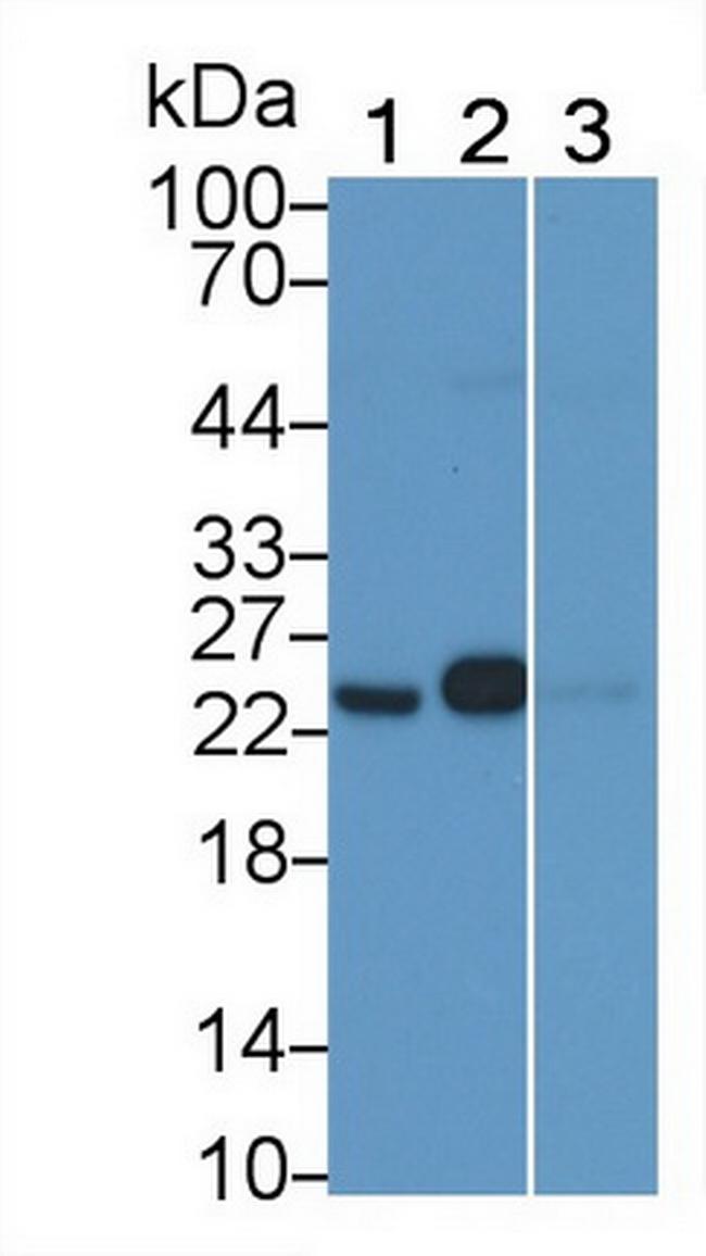 GSTP1 Antibody in Western Blot (WB)