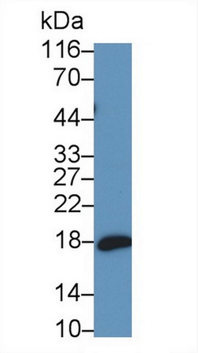 ProANP Antibody in Western Blot (WB)