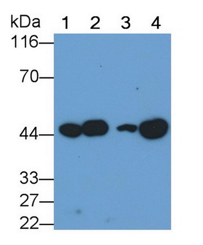 VEGFC Antibody in Western Blot (WB)