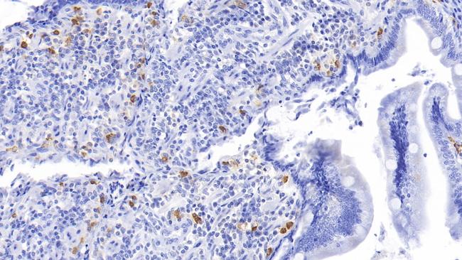 Tryptase Antibody in Immunohistochemistry (Paraffin) (IHC (P))