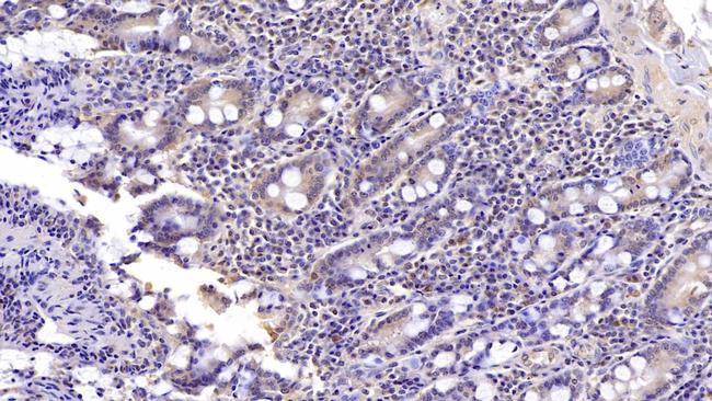 SHH Antibody in Immunohistochemistry (Paraffin) (IHC (P))