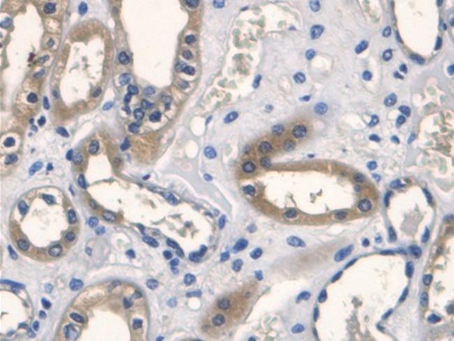 Procollagen I N-Peptide Antibody in Immunohistochemistry (Paraffin) (IHC (P))