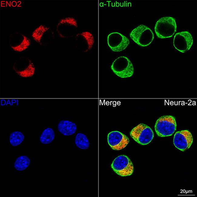 NSE Antibody in Immunocytochemistry (ICC/IF)