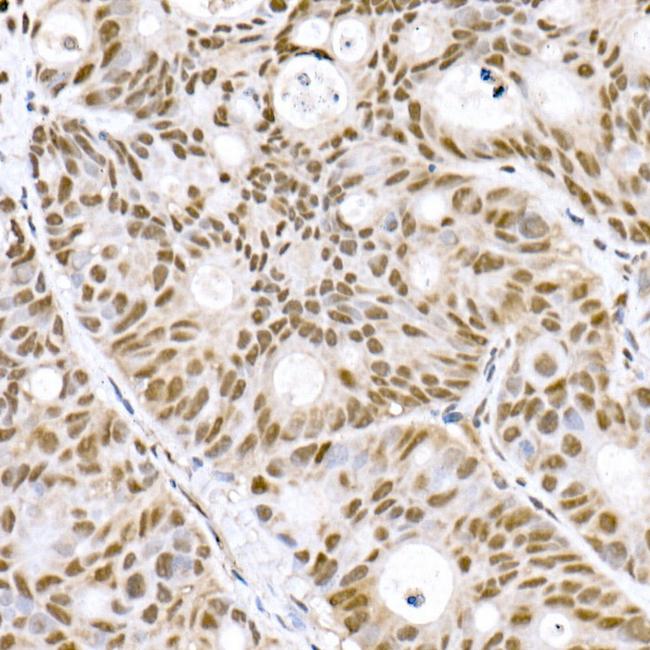 PRDM9 Antibody in Immunohistochemistry (Paraffin) (IHC (P))