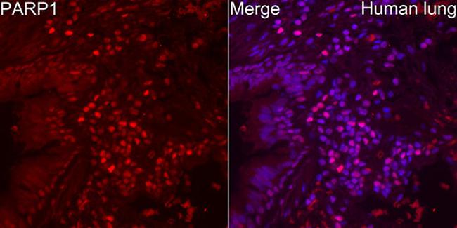 PARP1 Antibody in Immunocytochemistry (ICC/IF)