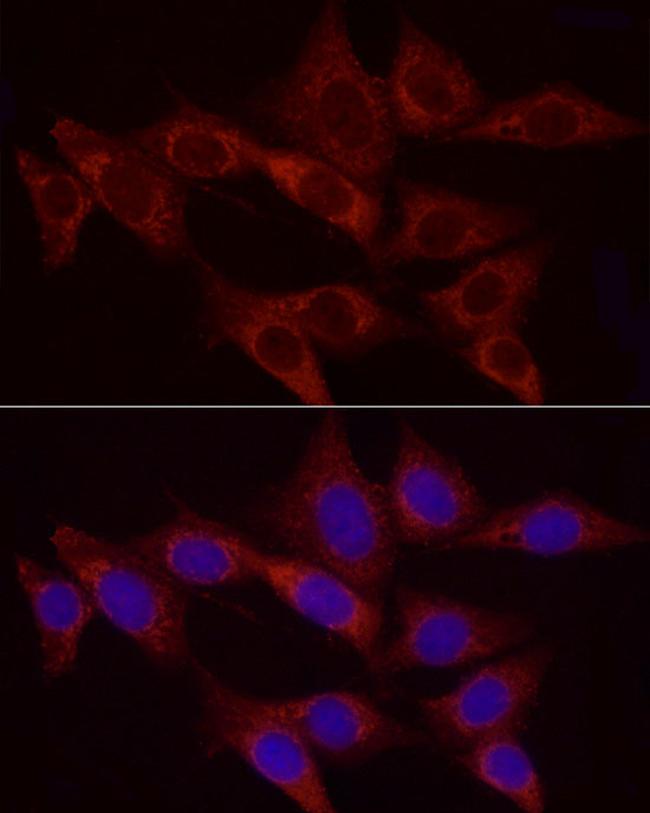 HK2 Antibody in Immunocytochemistry (ICC/IF)