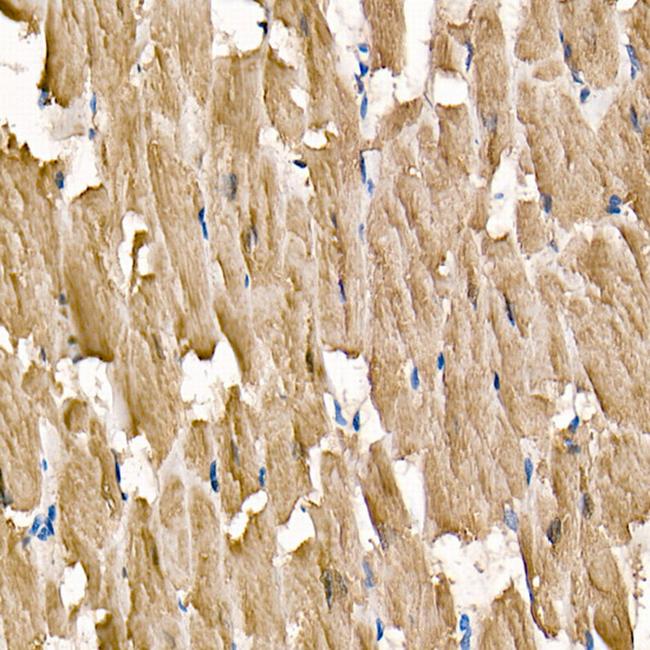 Cardiac Troponin I Antibody in Immunohistochemistry (Paraffin) (IHC (P))