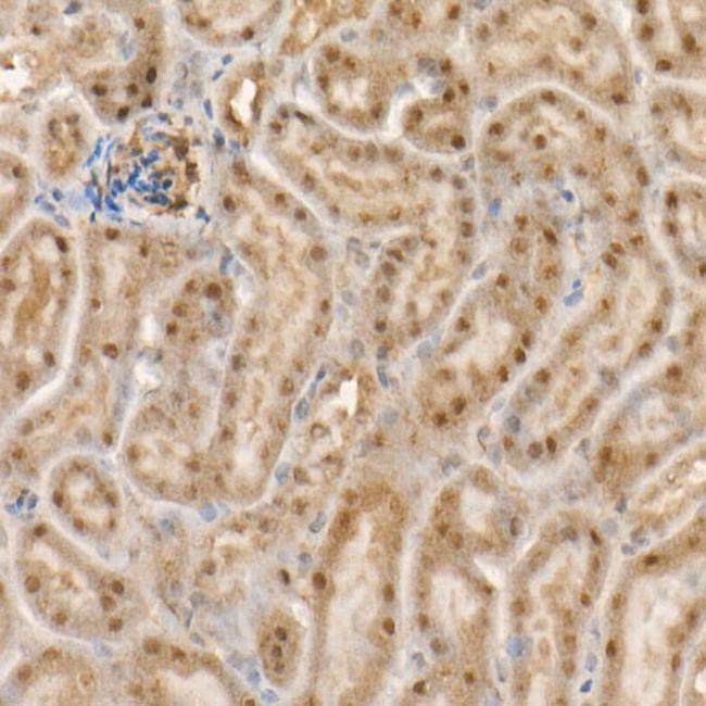 c-Abl Antibody in Immunohistochemistry (Paraffin) (IHC (P))