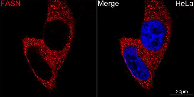 FASN Antibody in Immunocytochemistry (ICC/IF)