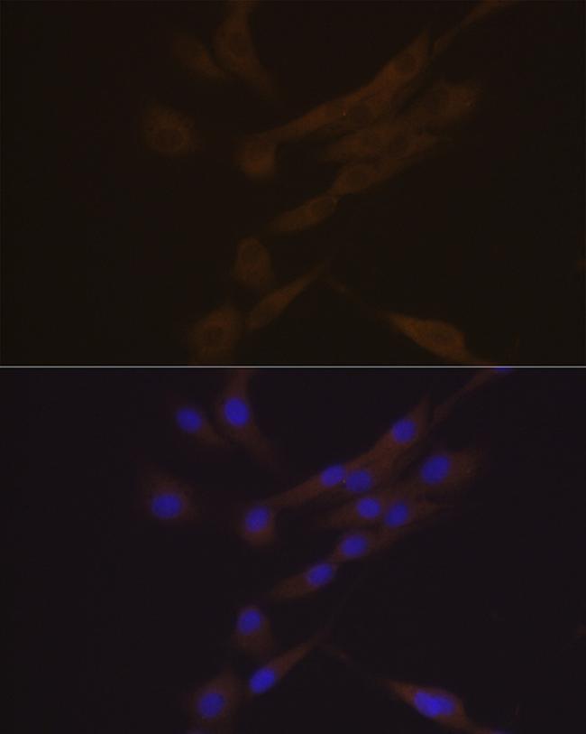 CHI3L1 Antibody in Immunocytochemistry (ICC/IF)