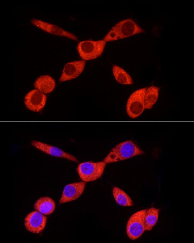 PKM2 Antibody in Immunocytochemistry (ICC/IF)