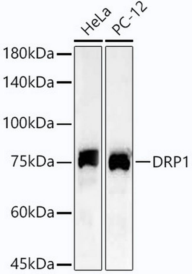 DNM1L Antibody in Western Blot (WB)